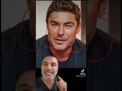 WHAT HAPPENED to Zac Efron's Jaw? Plastic Surgeon Explains!